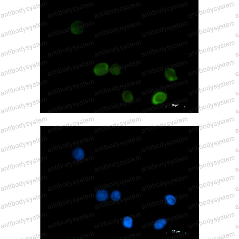 Anti-MTHFR Antibody (R1W34)