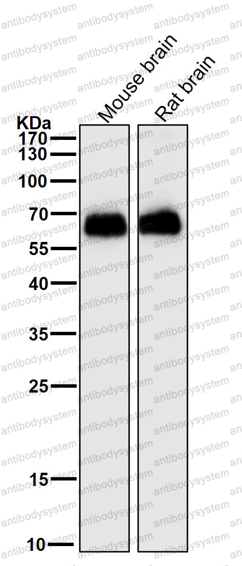 Anti-SLC1A3 Antibody (R1W35)
