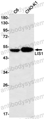 Anti-PAFAH1B1 Antibody (R1W39)
