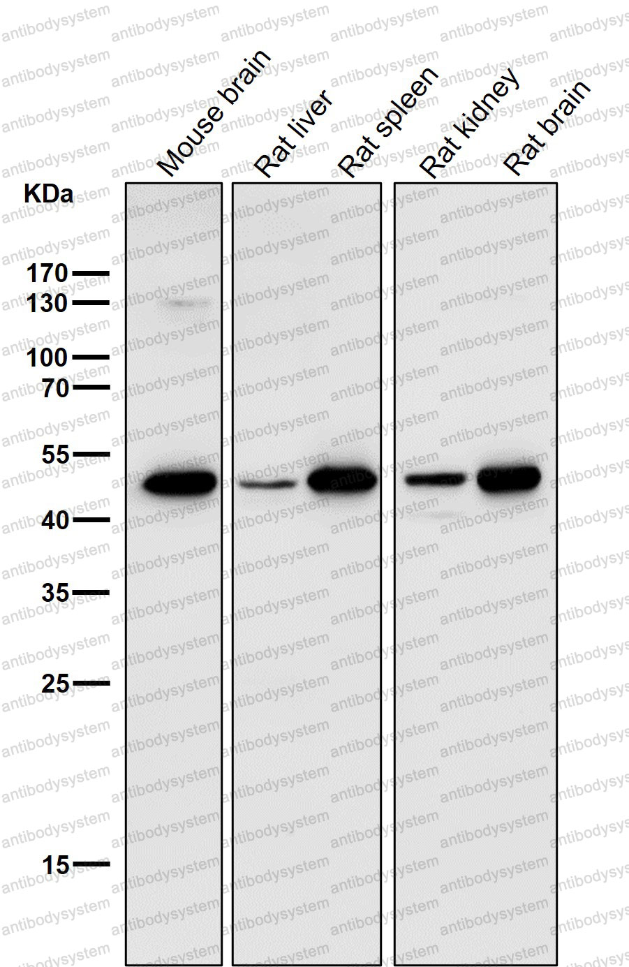 Anti-PAFAH1B1 Antibody (R1W38)