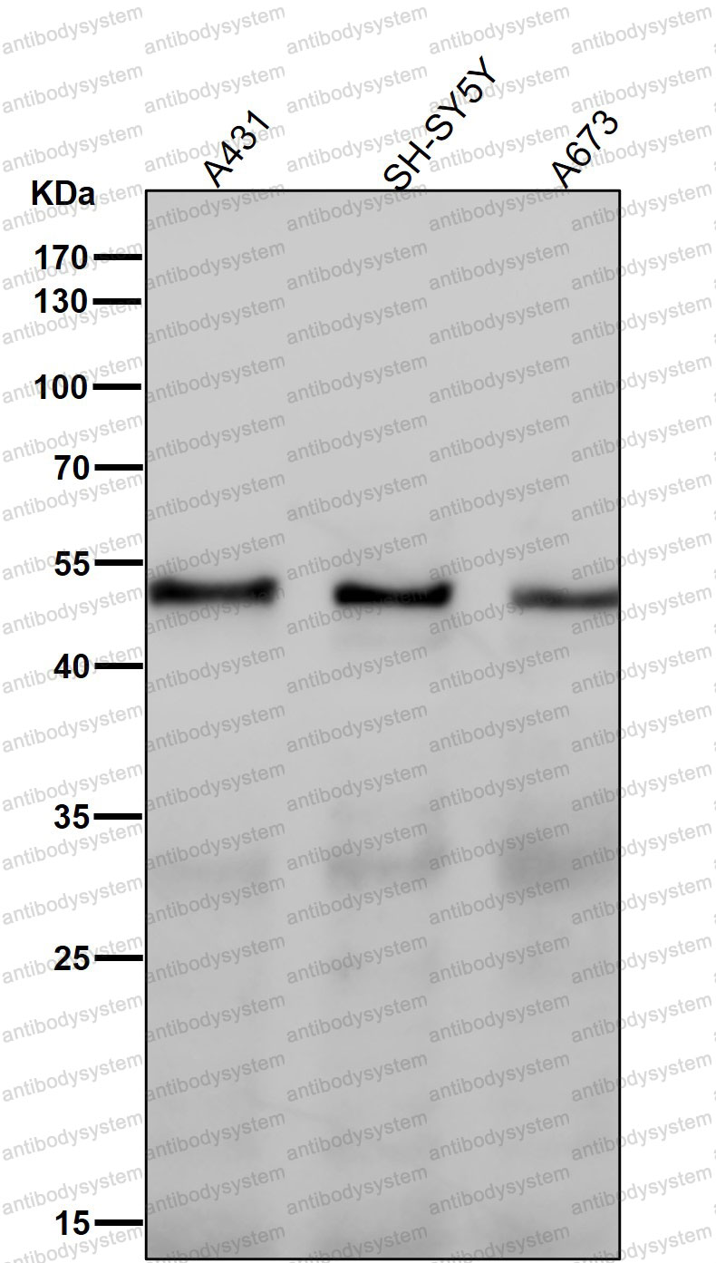 Anti-PTGER2 Antibody (R1W40)