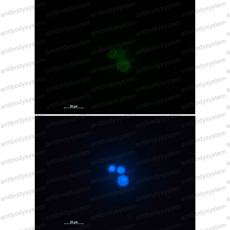 Anti-MATR3 Antibody (R1W43)