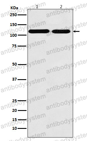 Anti-MATR3 Antibody (R1W42)