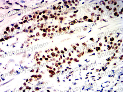 Immunohistochemical for Anti-MSH2 Antibody (R3L07) ?>