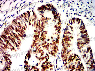 Immunohistochemical for Anti-MSH2 Antibody (R3L07) ?>