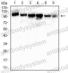 Western blot for Anti-MSH2 Antibody (R3L07) ?>