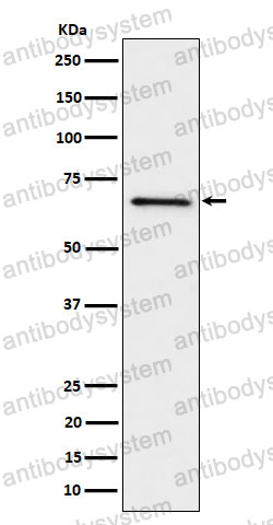 Anti-GRK6 Antibody (R1W46)