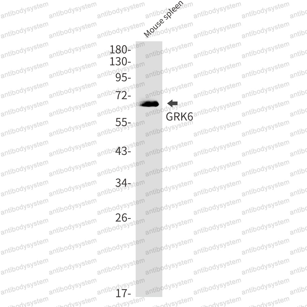 Anti-GRK6 Antibody (R1W47)