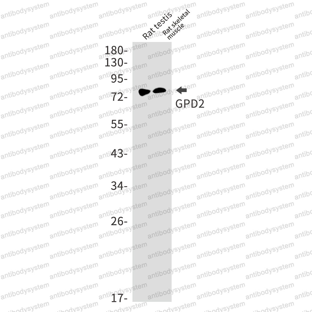 Anti-GPD2 Antibody (R1W48)