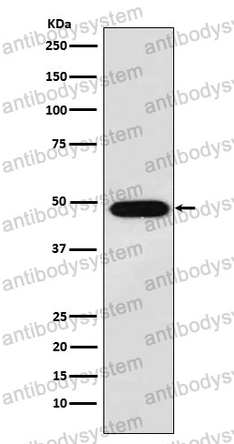 Anti-MAGEA1 Antibody (R1W49)