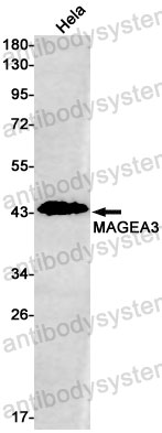 Anti-MAGEA3 Antibody (R1W50)