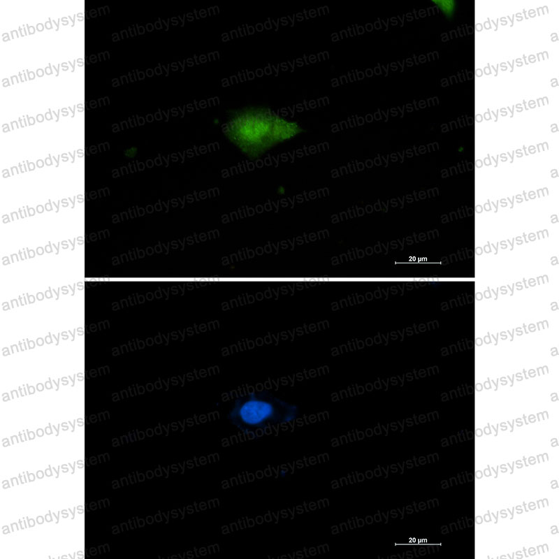 Anti-NAMPT Antibody (R1W53)