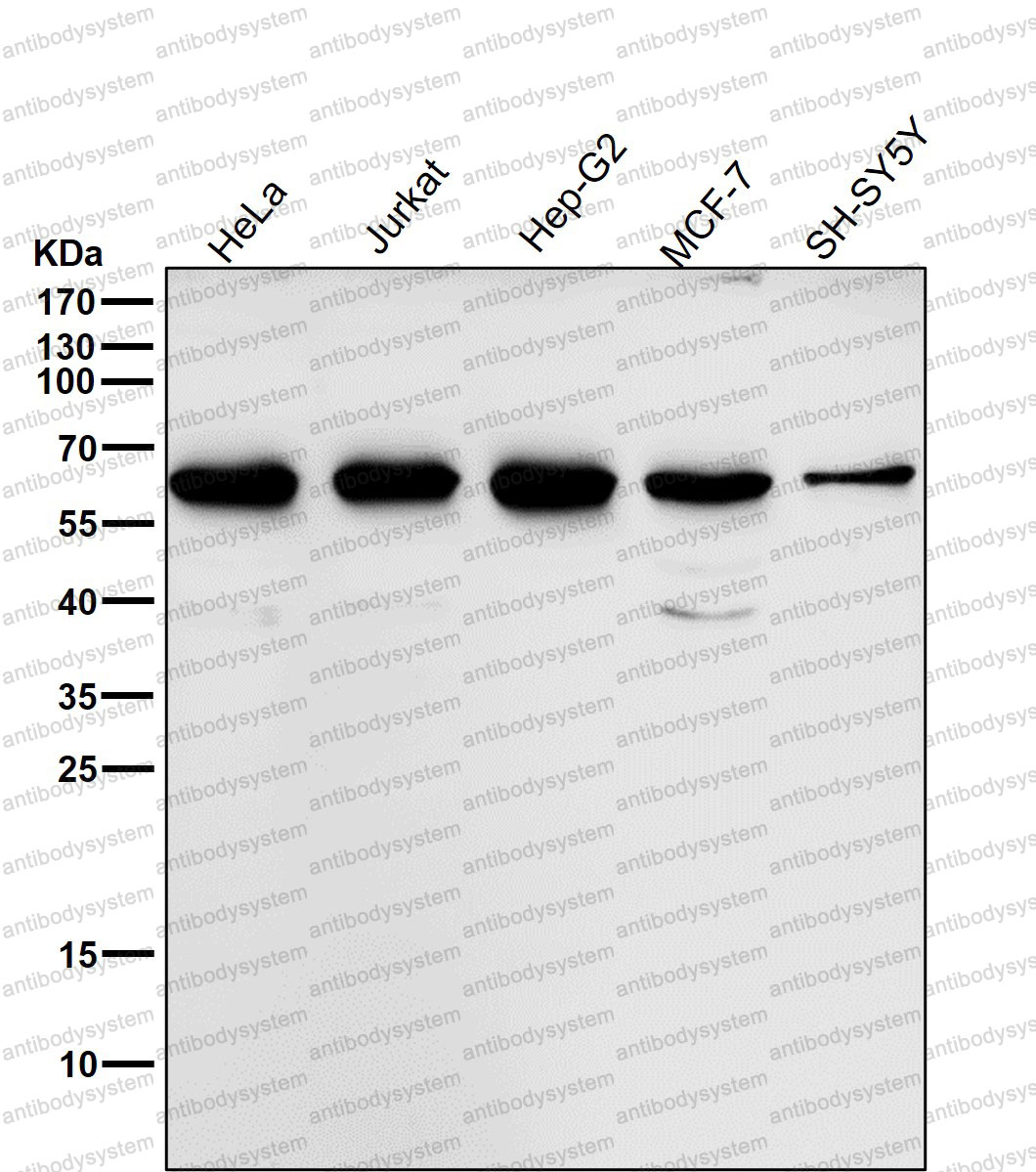 Anti-MMP13 Antibody (R1W61)