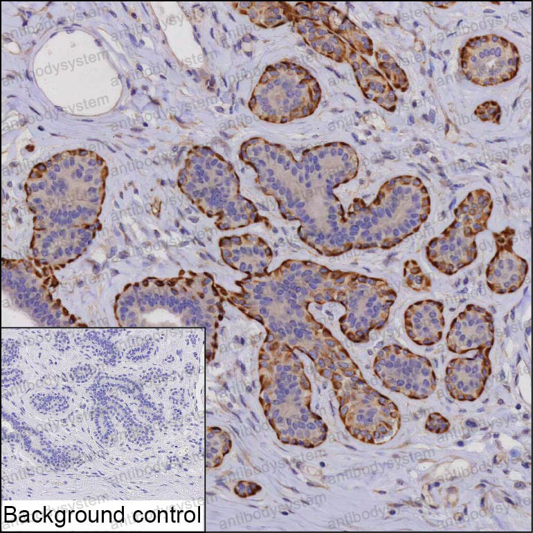 Immunohistochemical for Anti-MMP13 Antibody (R3L33) ?>