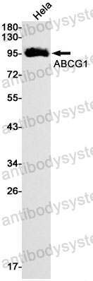 Anti-ABCG1 Antibody (R1W62)