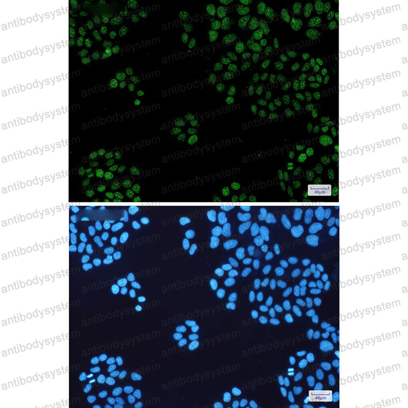 Anti-CBX5 Antibody (R1W63)