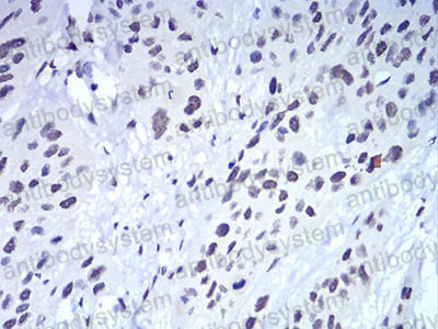 Immunohistochemical for Anti-CBX5 Antibody (R3L34) ?>