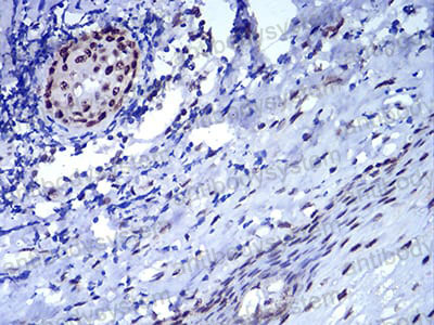 Immunohistochemical for Anti-CBX5 Antibody (R3L34) ?>