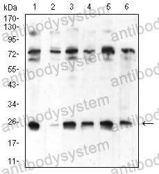 Western blot for Anti-CBX5 Antibody (R3L34) ?>