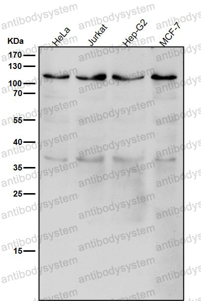 Anti-USP5 Antibody (R1W64)