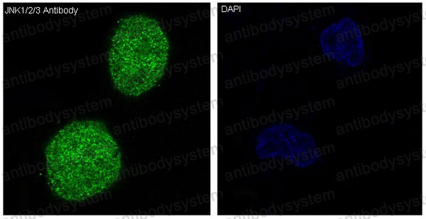 Anti-JNK1/2/3 Antibody (R1C15)