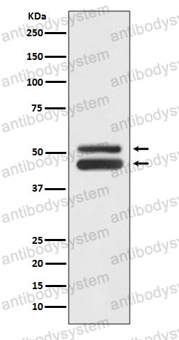 Anti-JNK1/JNK3 Antibody (R1W65)