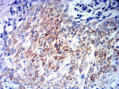 Immunohistochemical for Anti-CCR10 Antibody (R3L49) ?>