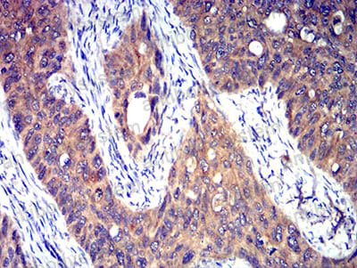 Immunohistochemical for Anti-5HT3/HTR3A Antibody (R3L50) ?>