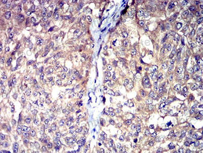 Immunohistochemical for Anti-5HT3/HTR3A Antibody (R3L50) ?>