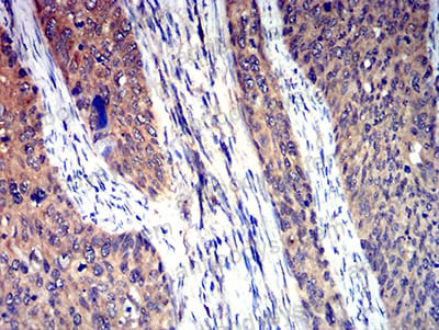 Immunohistochemical for Anti-5HT3/HTR3A Antibody (R3L51) ?>