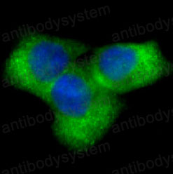 Anti-NOTCH1 Antibody (R1A99)
