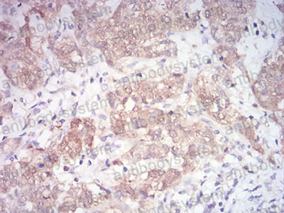 Immunohistochemical for Anti-MAP2K3 Antibody (R3L55) ?>