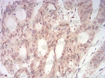 Immunohistochemical for Anti-MAP2K3 Antibody (R3L55) ?>