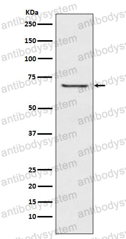 Anti-GABRB2 Antibody (R1W97)