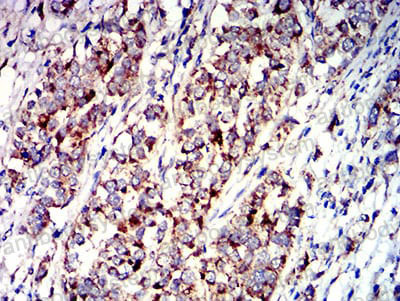 Immunohistochemical for Anti-P2RY1 Antibody (R3L61) ?>