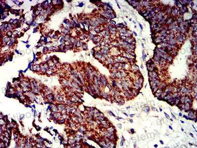 Immunohistochemical for Anti-P2RY1 Antibody (R3L61) ?>