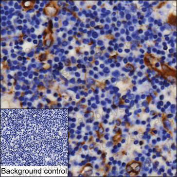 Immunohistochemical for Anti-XCL1/Lymphotactin Antibody (R3L67) ?>