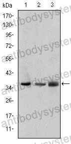 Western blot for Anti-LIMS1 Antibody (R3L69) ?>