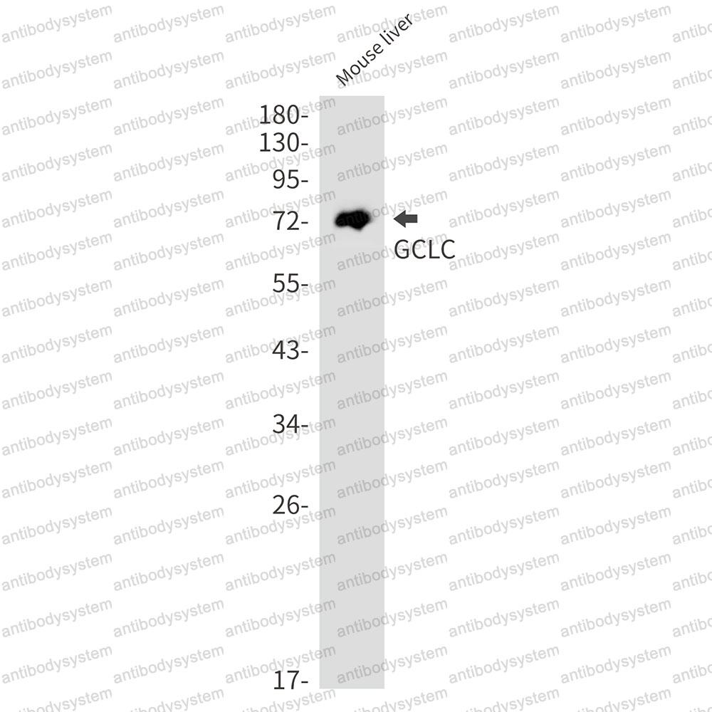 Anti-GCLC Antibody (R1X11)