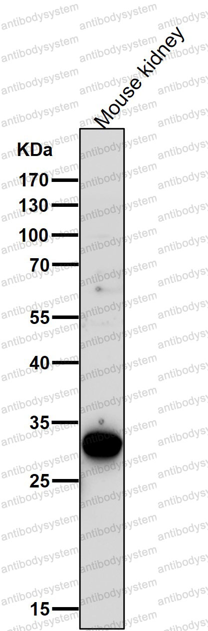 Anti-GCLM Antibody (R1X12)