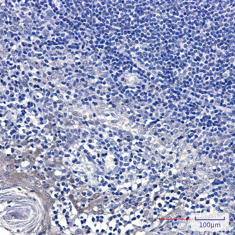 Anti-GCLM Antibody (R1X13)