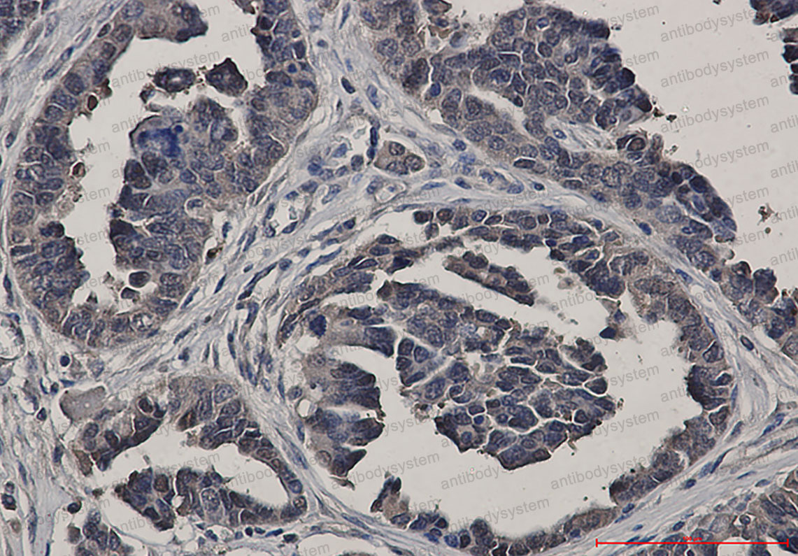 Anti-GSS Antibody (R1X16)