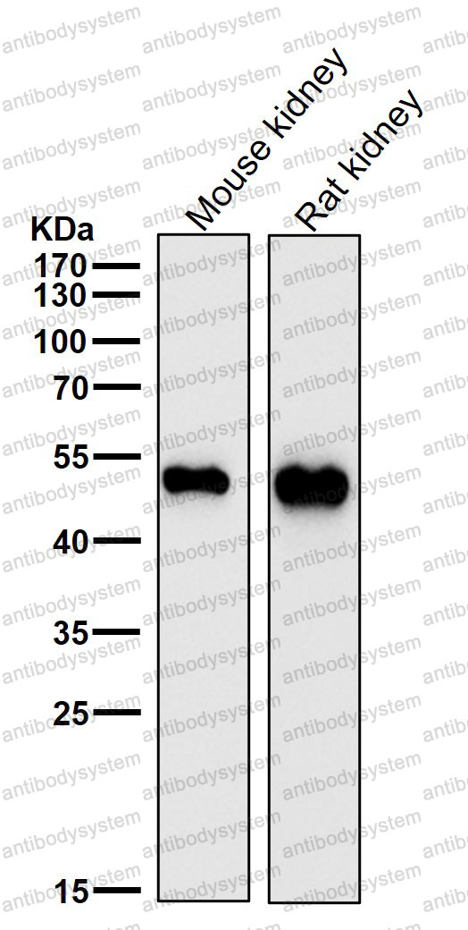 Anti-GSS Antibody (R1X14)