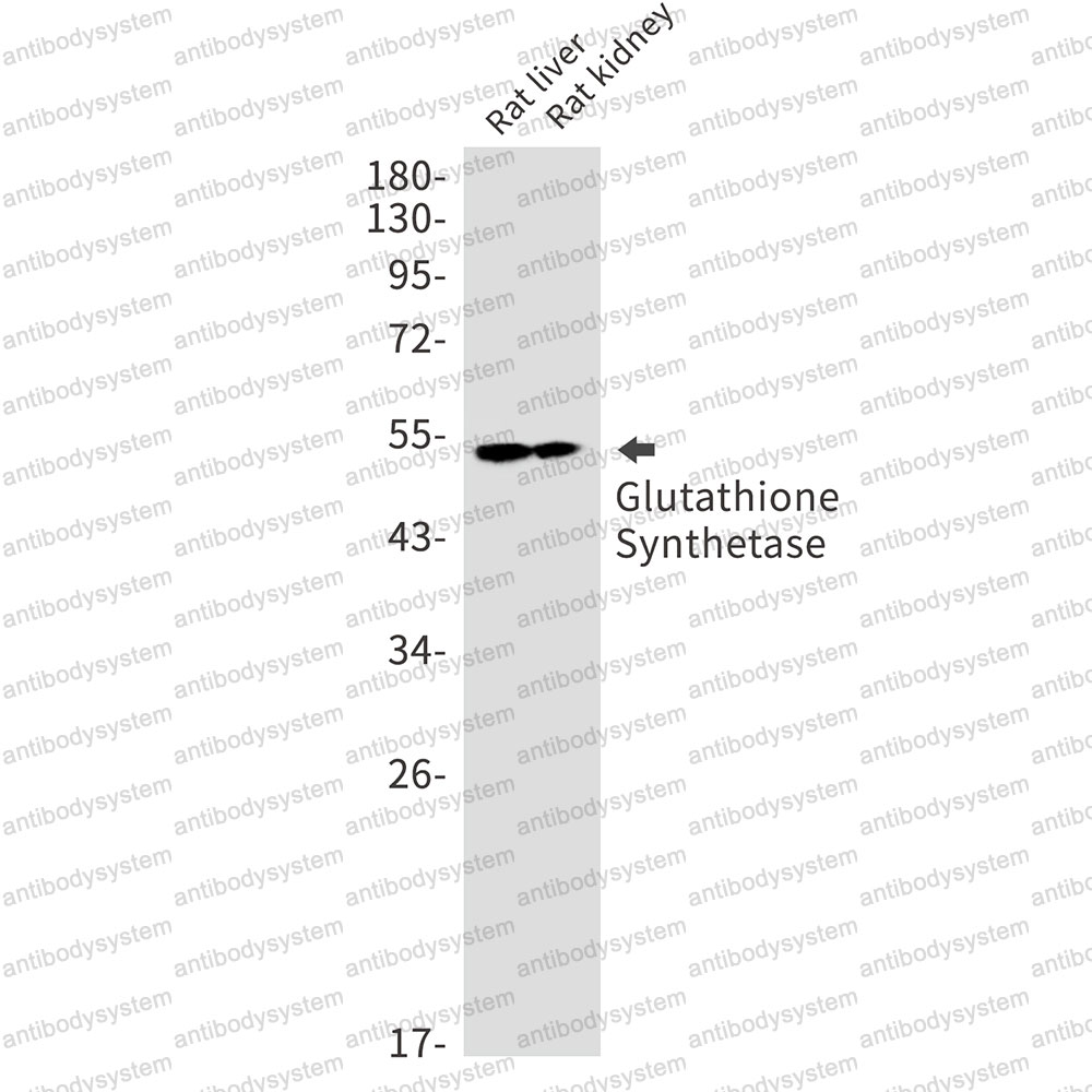 Anti-GSS Antibody (R1X15)