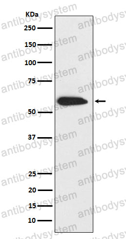 Anti-KRT6C Antibody (R1X17)