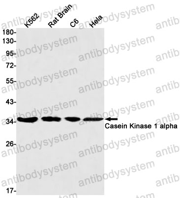 Anti-CSNK1A1 Antibody (R1X19)