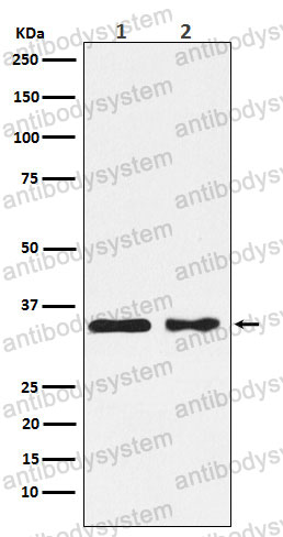 Anti-CSNK1A1 Antibody (R1X18)