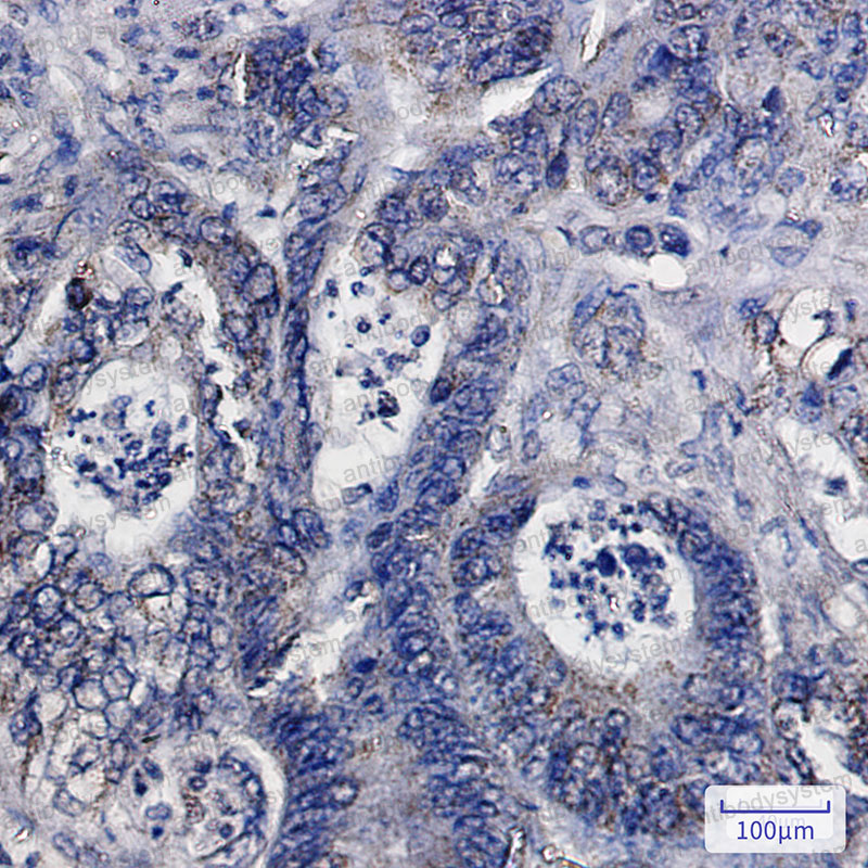 Anti-IDH2 Antibody (R1X20)