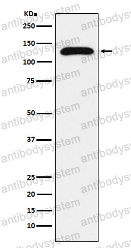 Anti-TRPC1/TRP-1 Antibody (R1X22)