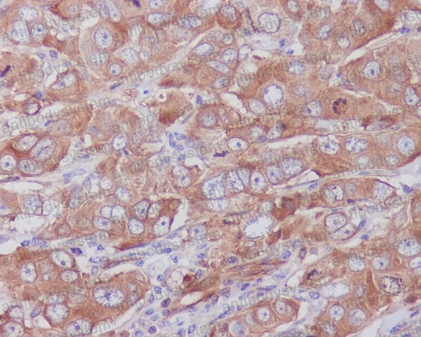 Anti-PXN/Paxillin Antibody (R1B11)